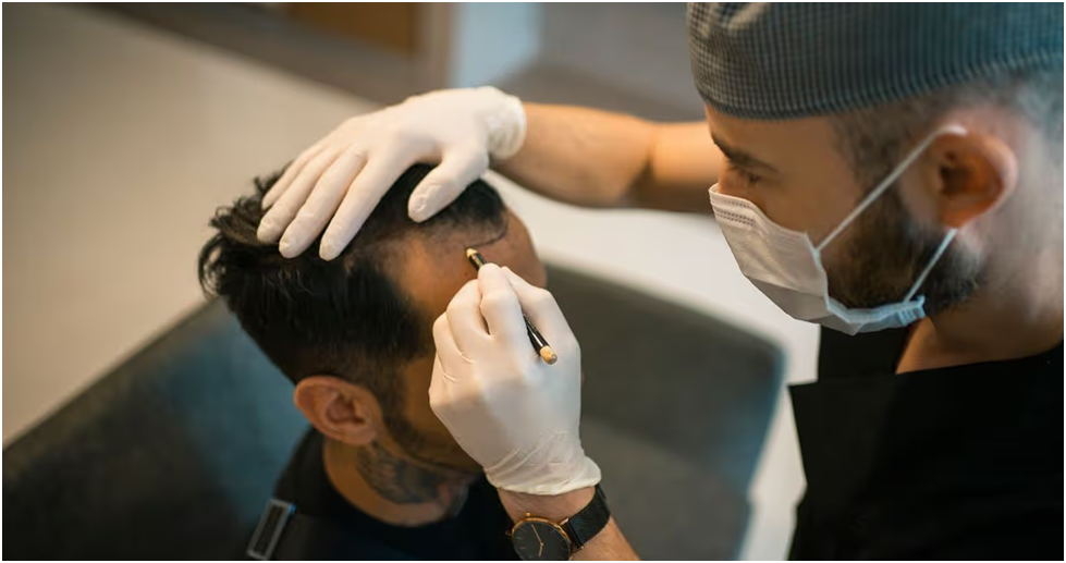Hair Loss Treatment Options: From Early Care to Advanced Solutions
